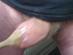 Foreskin extravaganza - 4 of 4