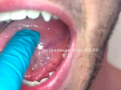 Fétiche Dentaire - Edward Teeth Part4 Video2